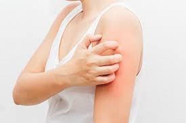 Tại Sao Nhiễm Sán Chó Lại Gây Ngứa Kéo Dài